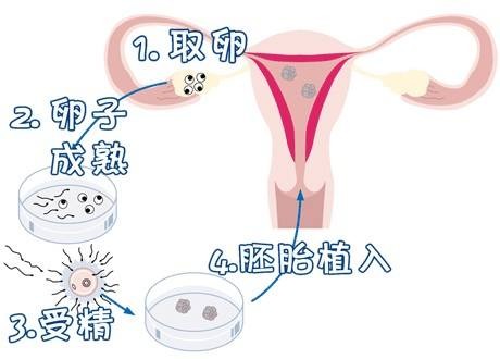 代怀选性别包生男孩